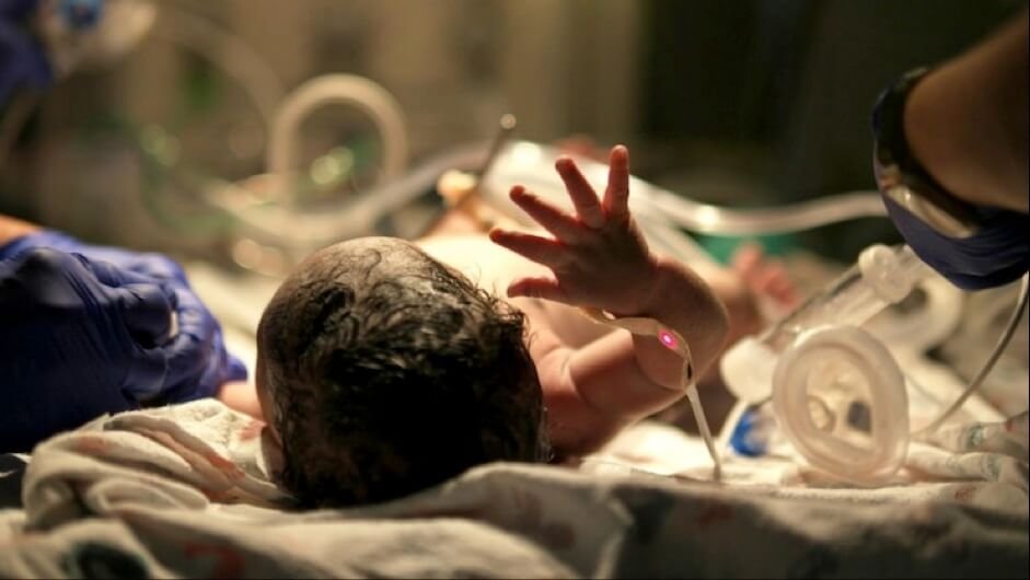 birth injury malpractice